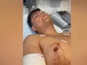 Balean a hijo de candidato a presidente municipal de Metepec