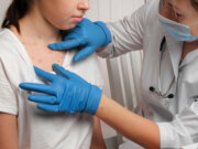 Vacuna contra viruela del mono podría aplicarse muy pronto en México: Cofepris