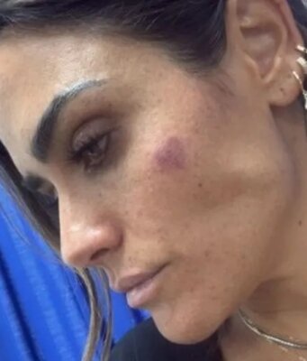 Agreden a la alcaldesa de la Cuauhtémoc, Alessandra Rojo